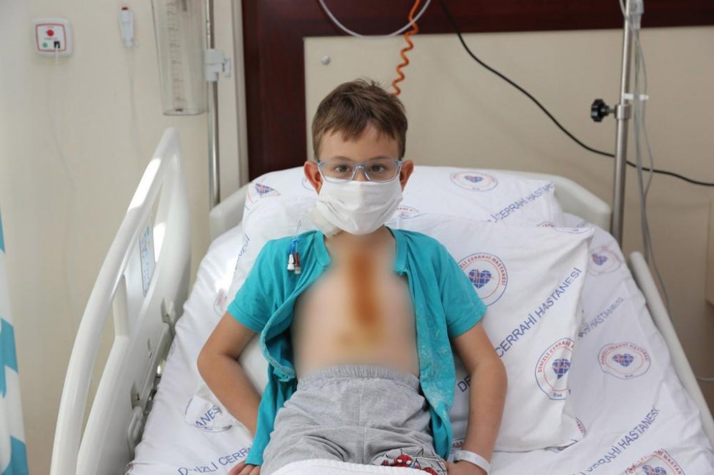 Denizli’de doğuştan kalp deliği rahatsızlığı bulunan 8 yaşındaki çocuk, Özel Denizli Cerrahi Hastanesi’nde gerçekleştirilen başarılı bir ameliyatla sağlığına kavuştu.